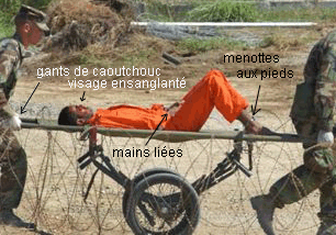 Guantanamo détenu sur chariot 2